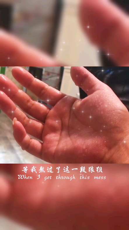男的出手汗是怎么回事_男生出手汗是什么原因_男生出手汗是不是肾虚