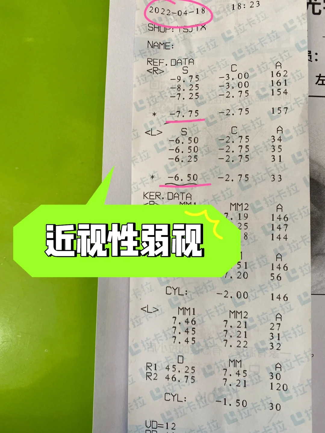 弱视治疗软件作用大吗_治疗软件弱视有哪些_弱视 治疗 软件